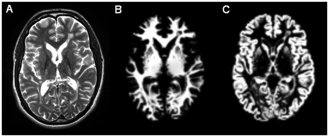 Fig. 2