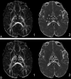 Fig 1.