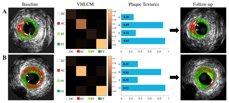 Fig. 4