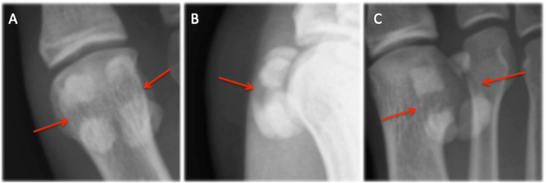 Fig. 2