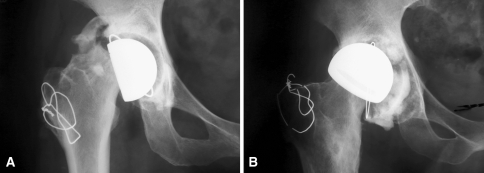 Fig. 5A–B