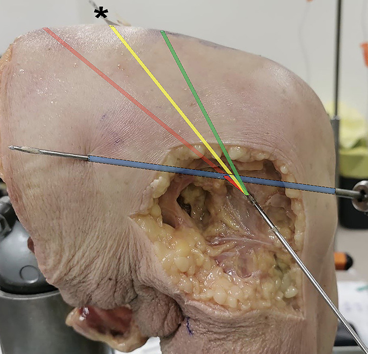 Figure 4.