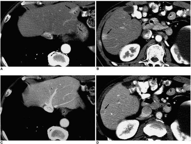 Fig. 12