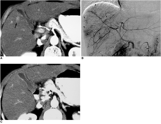 Fig. 11