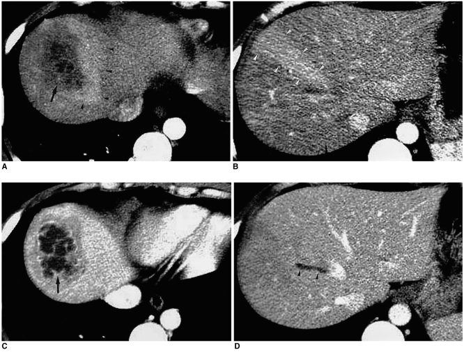 Fig. 13