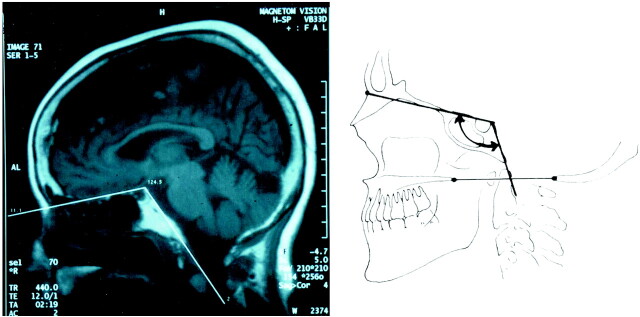 Fig 2.