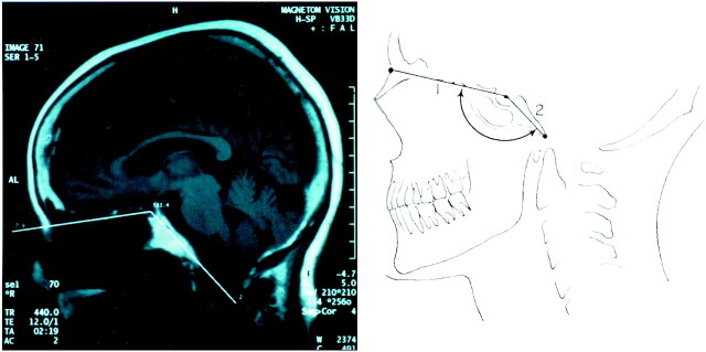 Fig 1.