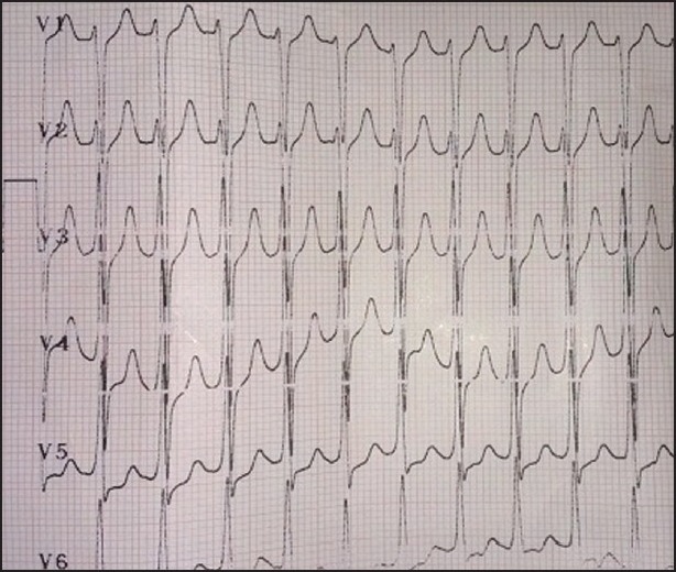 Figure 1b