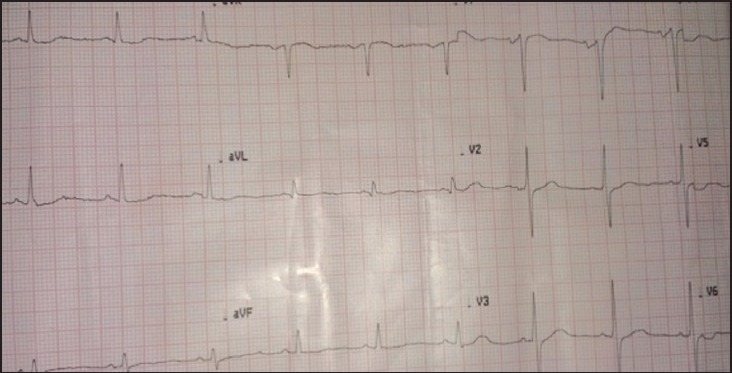 Figure 1a