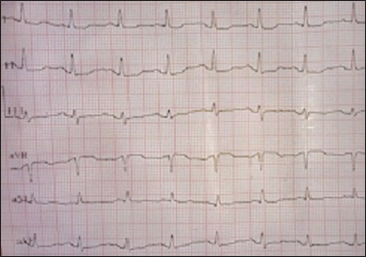 Figure 1c