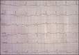 Figure 1c