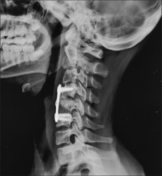 Figure 10