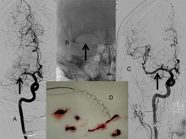 Figure 1