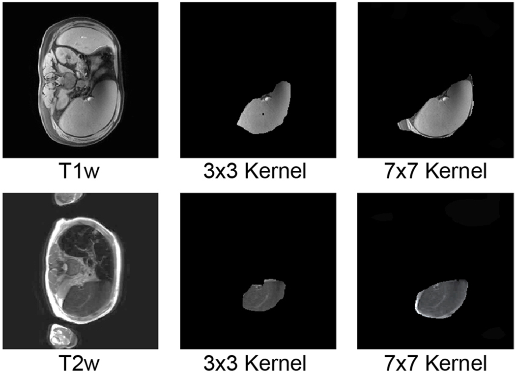 Fig. 2.