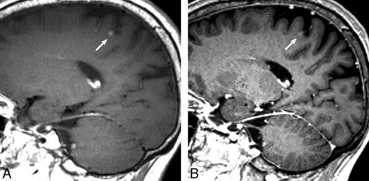 Fig 4.