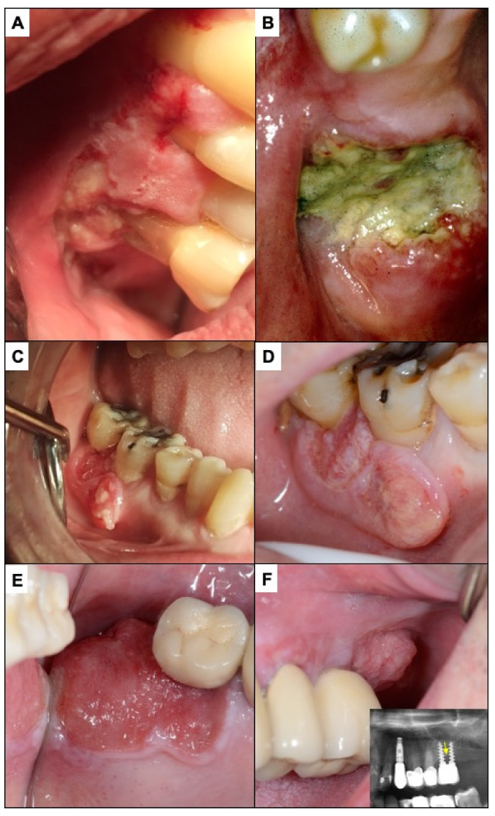 Figure 10