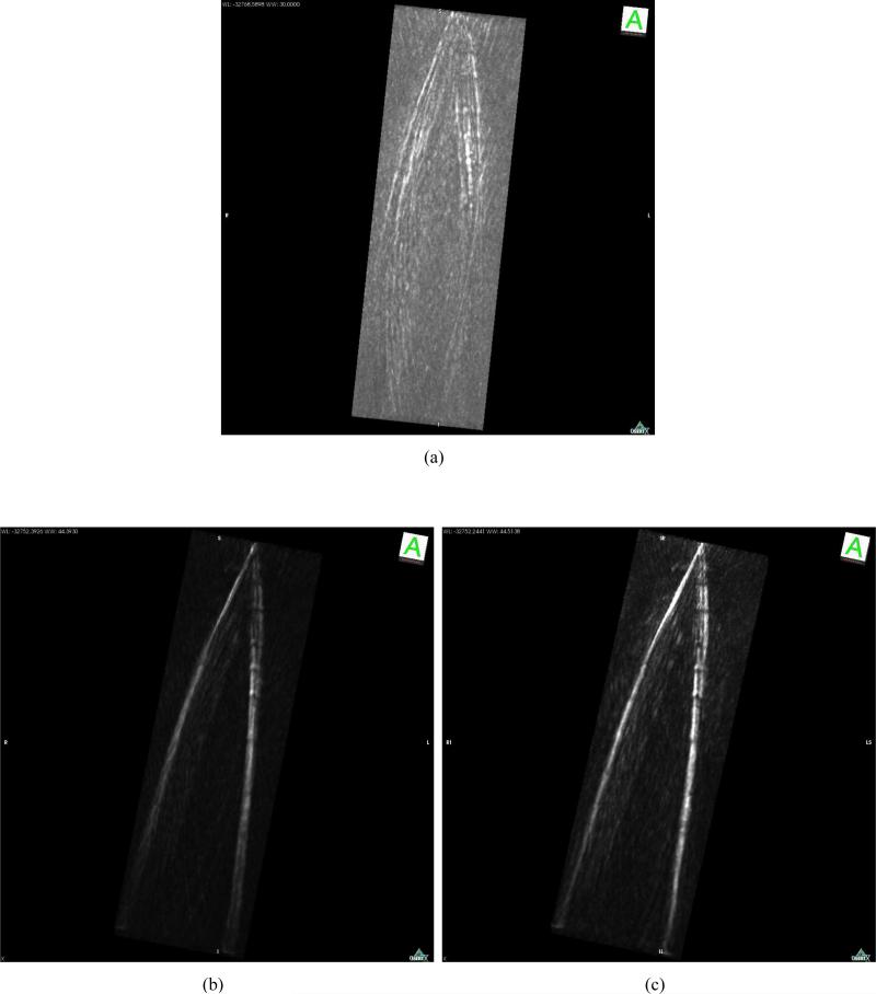 Fig. 13