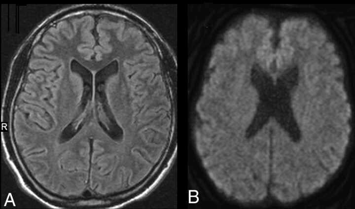 Fig 2.