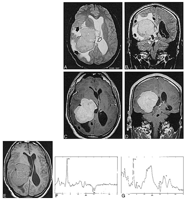 fig 2.