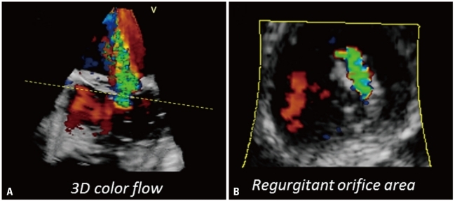 Fig. 16