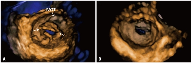 Fig. 15