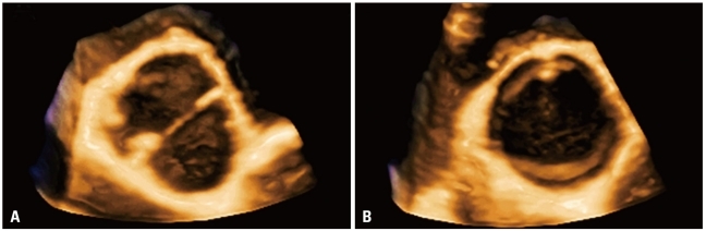 Fig. 14