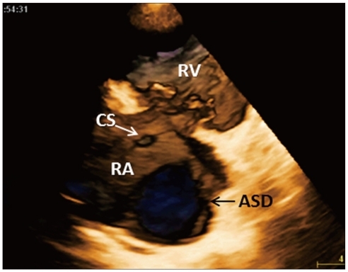 Fig. 13