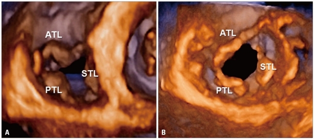 Fig. 18