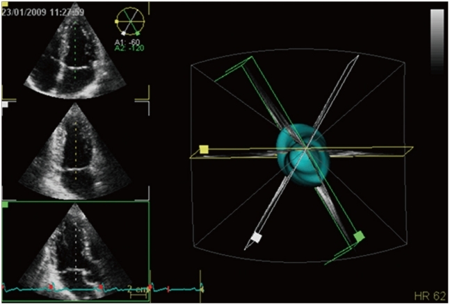 Fig. 11