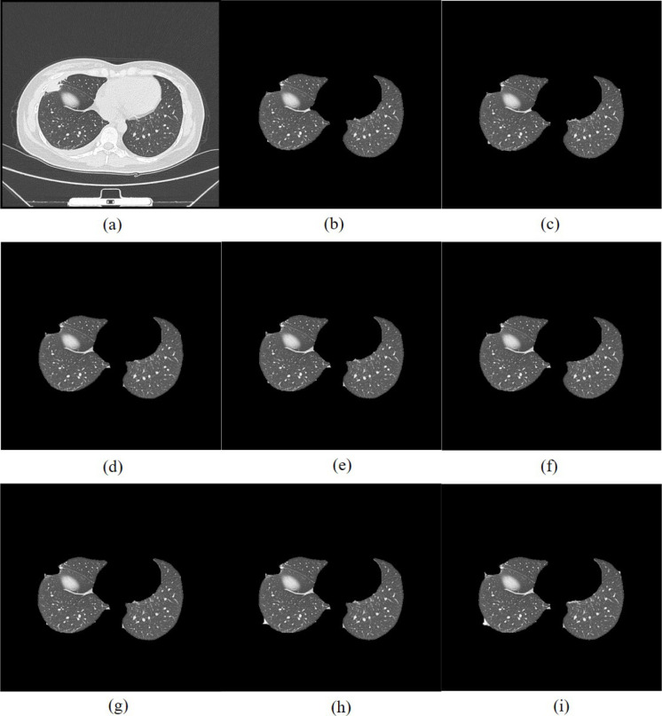 Fig. 17