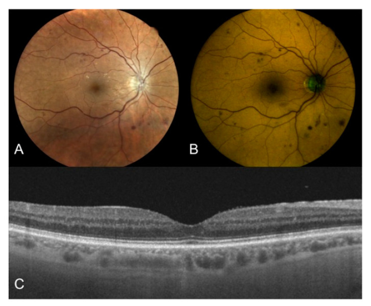 Figure 2