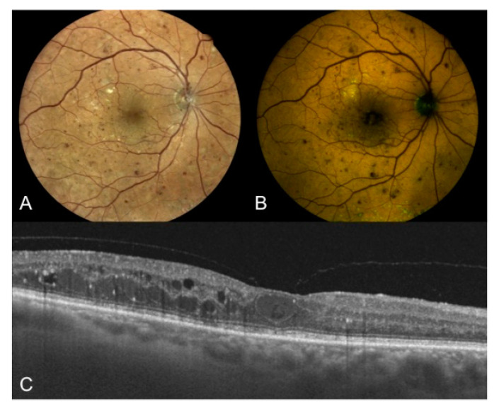 Figure 3