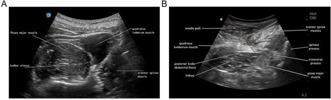 Fig. 1.
