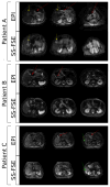 Fig. 10