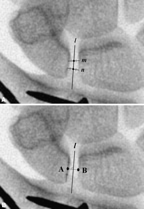 Fig. 1A–B