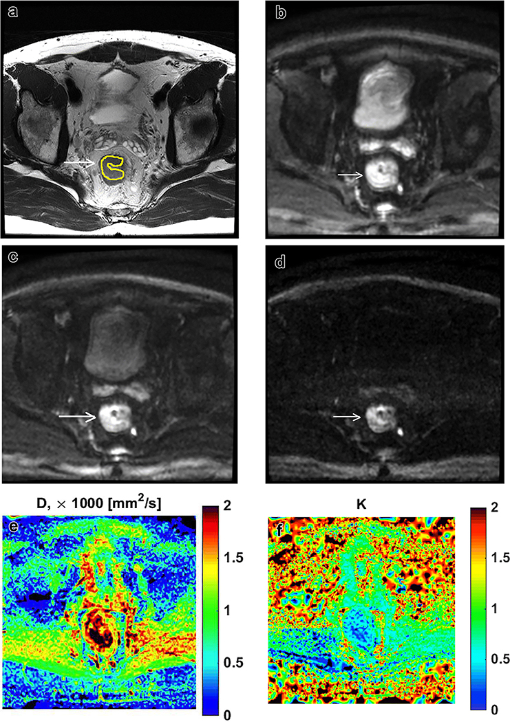 Figure 1: