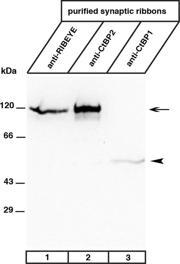 Figure 11.