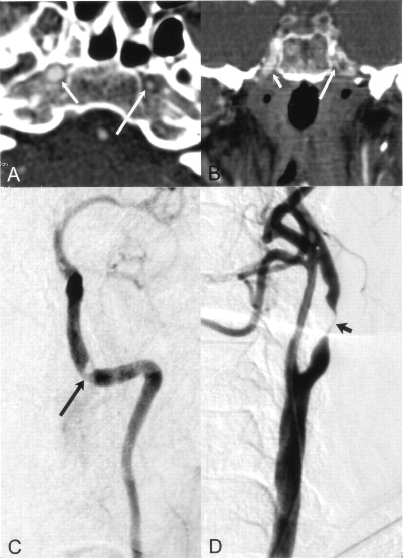 Fig 3.