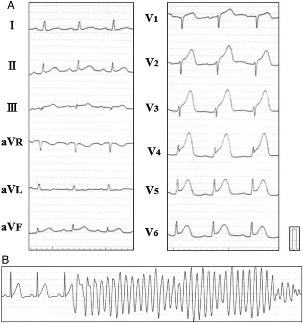 Figure 3