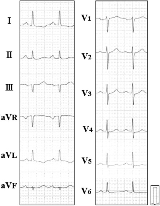 Figure 1