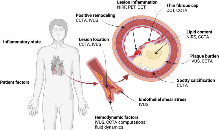 Fig. 1