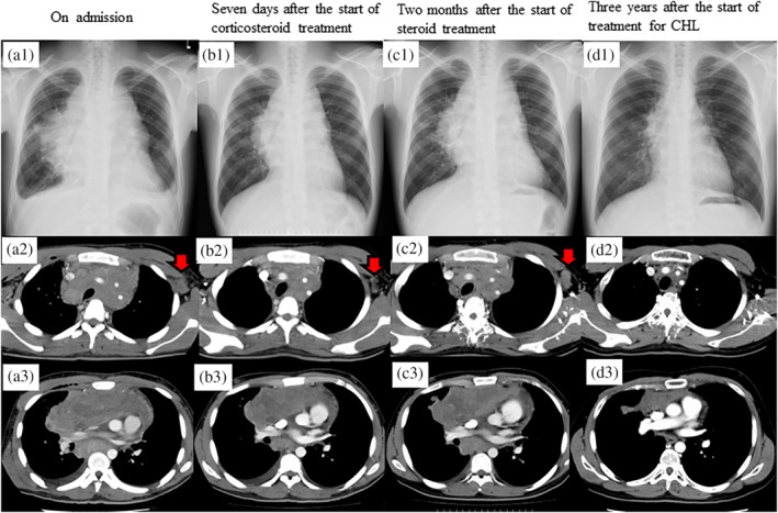 FIGURE 1