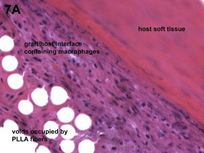 Fig. 7-A Fig. 7-B