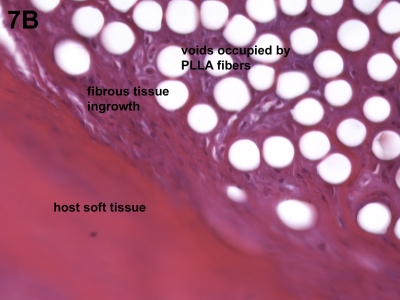 Fig. 7-A Fig. 7-B