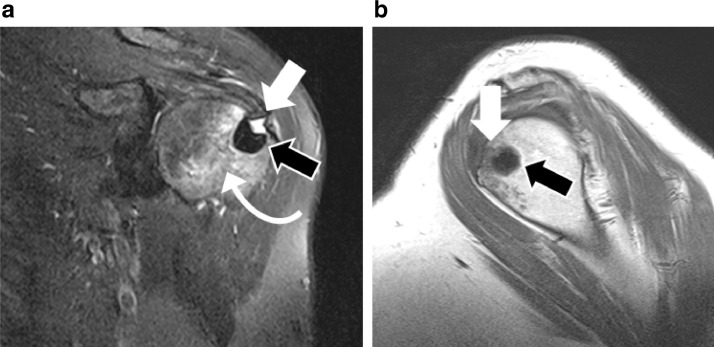 Fig 2 –