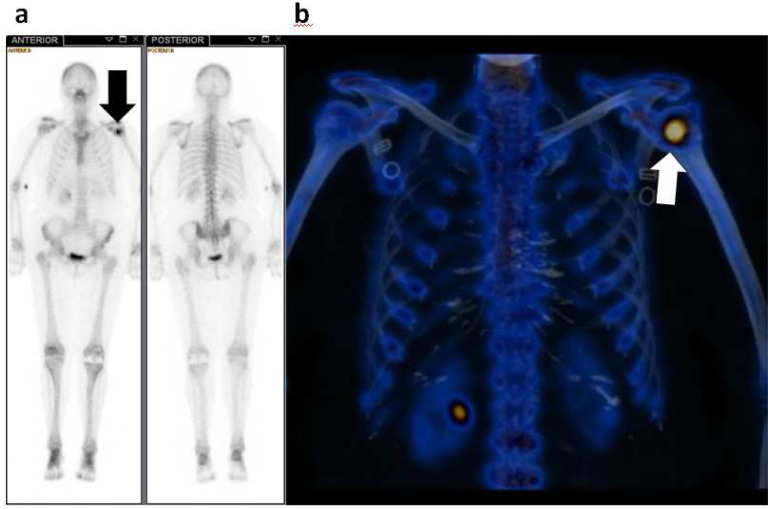 Fig 3 –