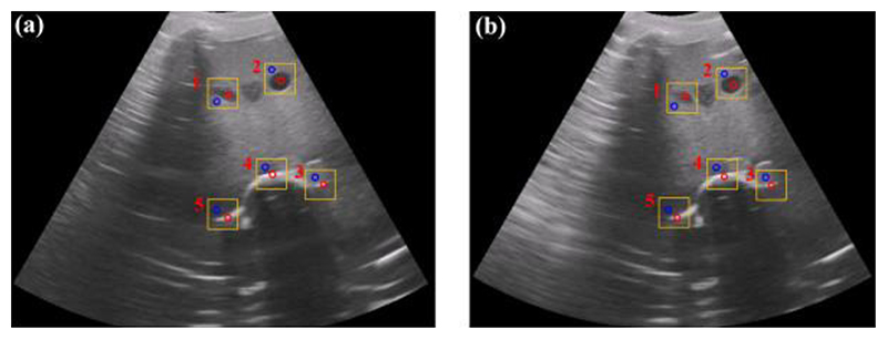 Fig. 16