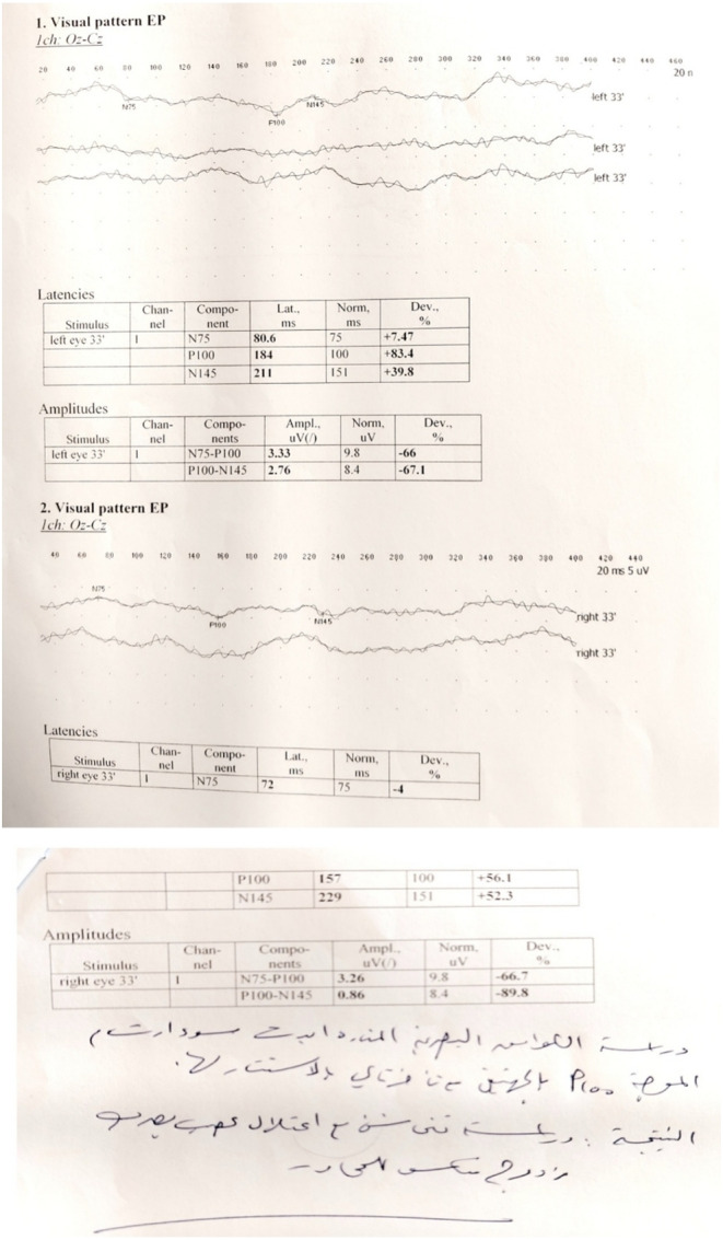 FIGURE 3