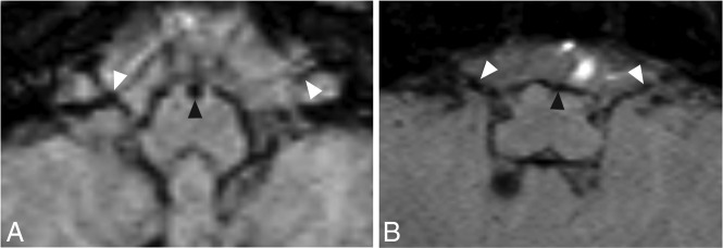 FIG 5.