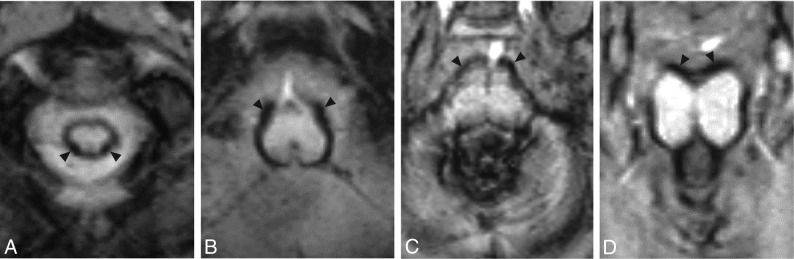 FIG 2.